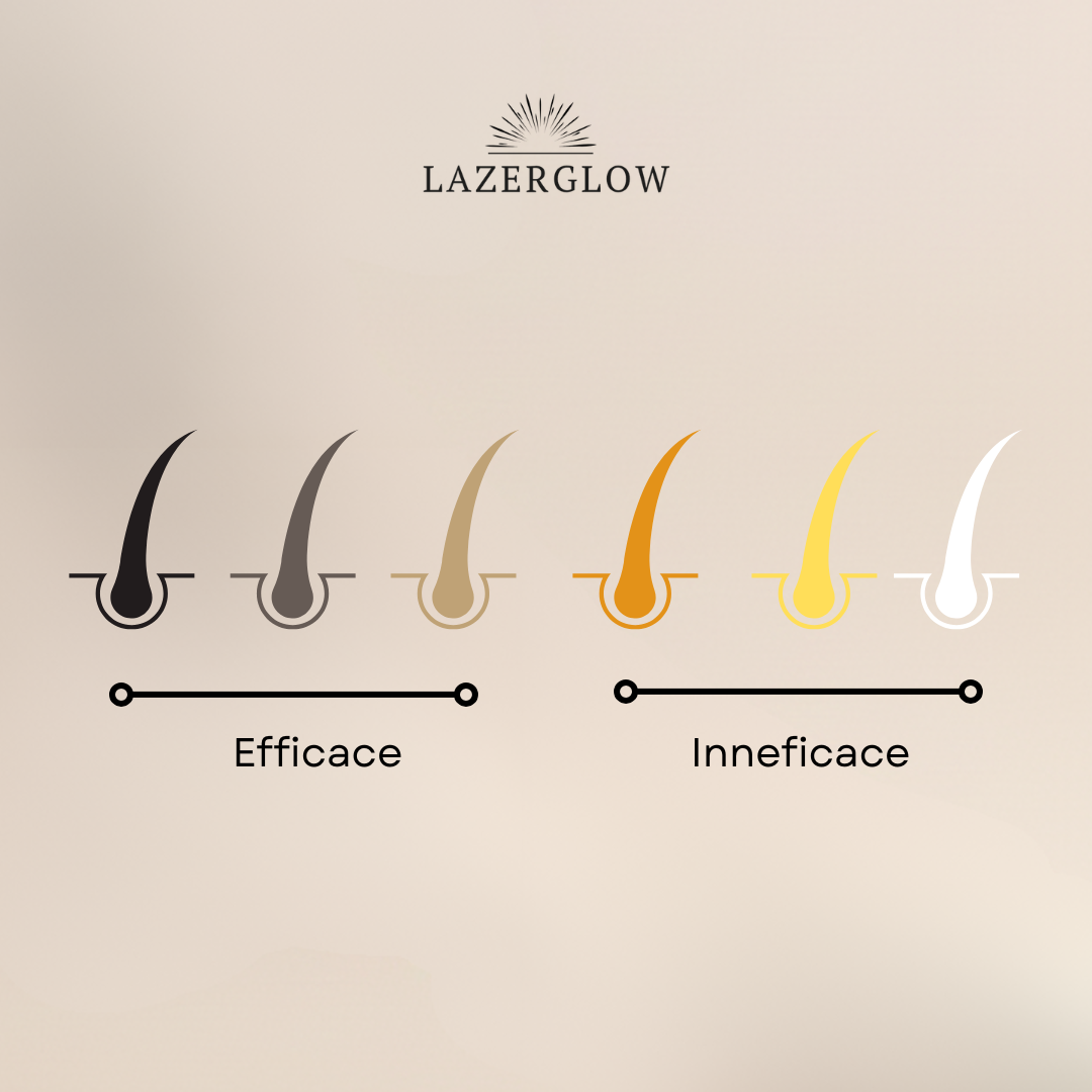 Épilateur à lumière Pulsée - Lazerglow